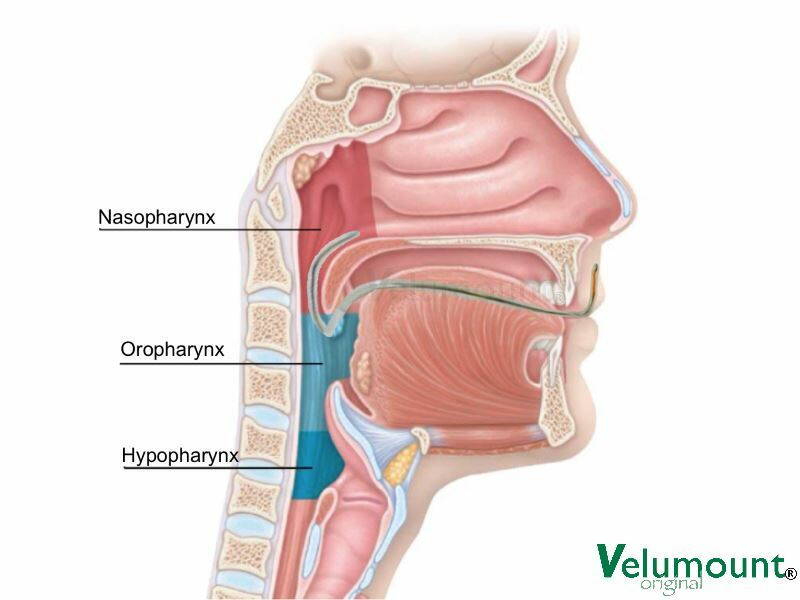 velumount-original-stabilisiert-gaumen-gegen-schnarchen-seitenschnitt-anatomie.jpg velumount-original-stabilisiert-gaumen-gegen-schnarchen-seitenschnitt-anatomie.jpg